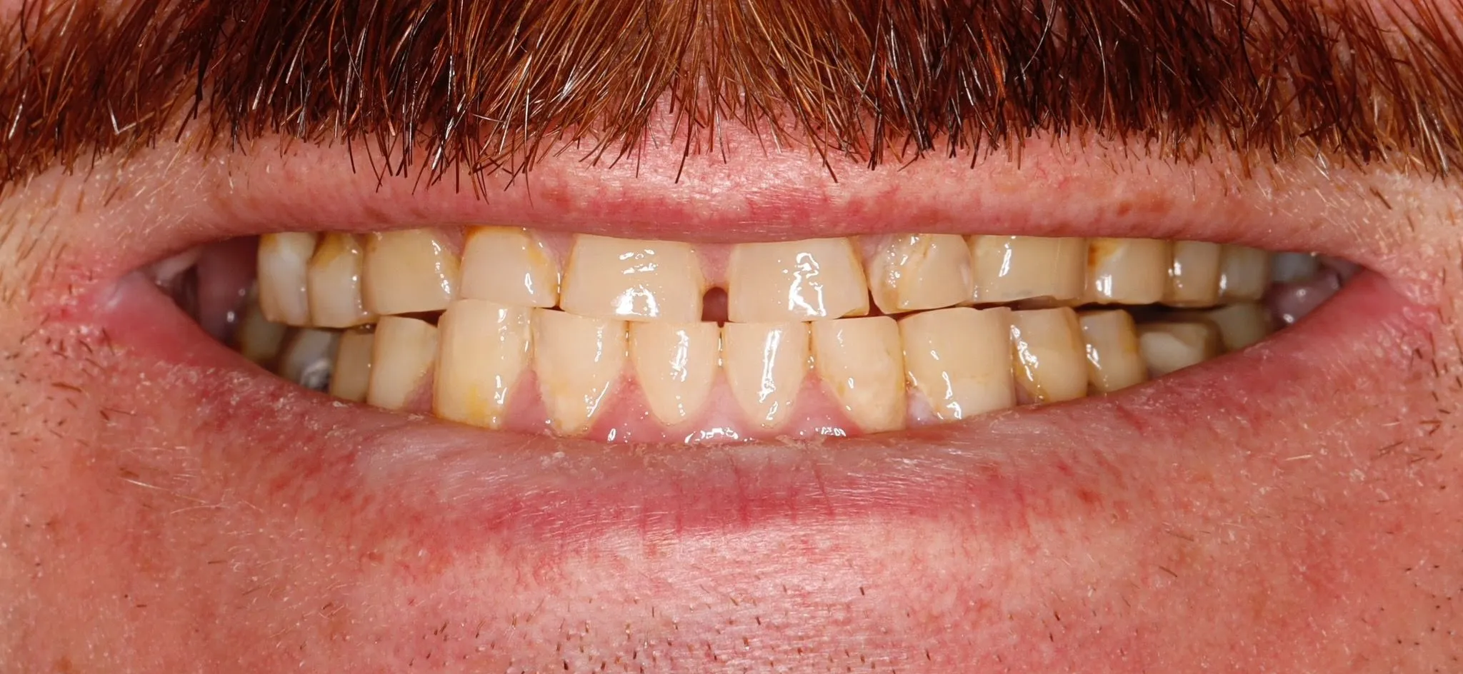 Case 1 Before