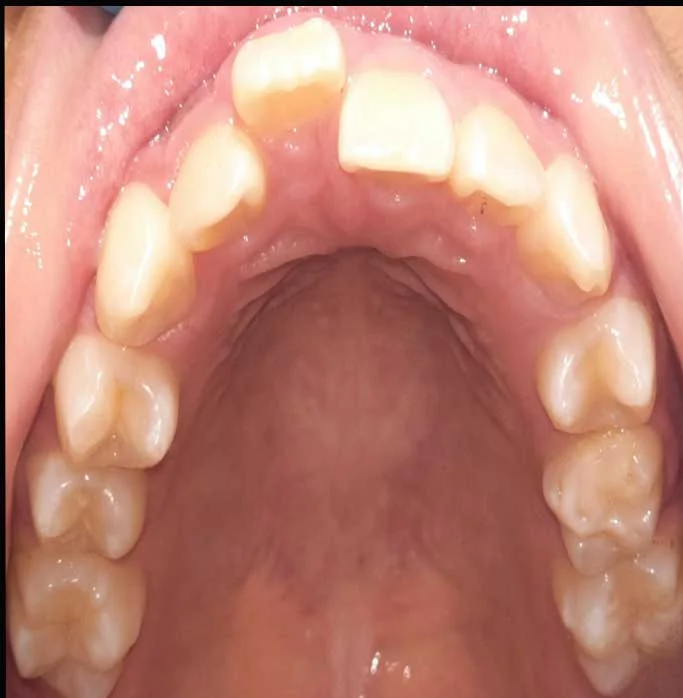 Case 4 Before