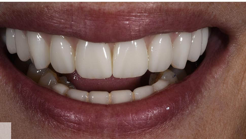 Case 2 After