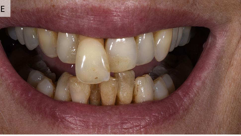Case 2 Before