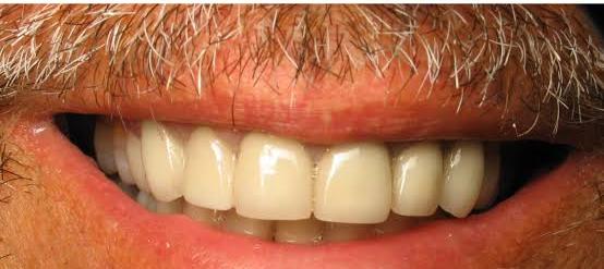 Case 5 After
