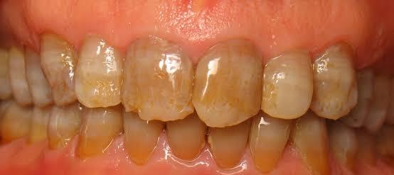 Case 5 Before