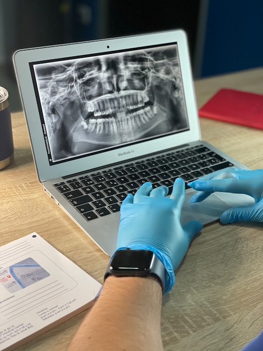 Digital X-Rays